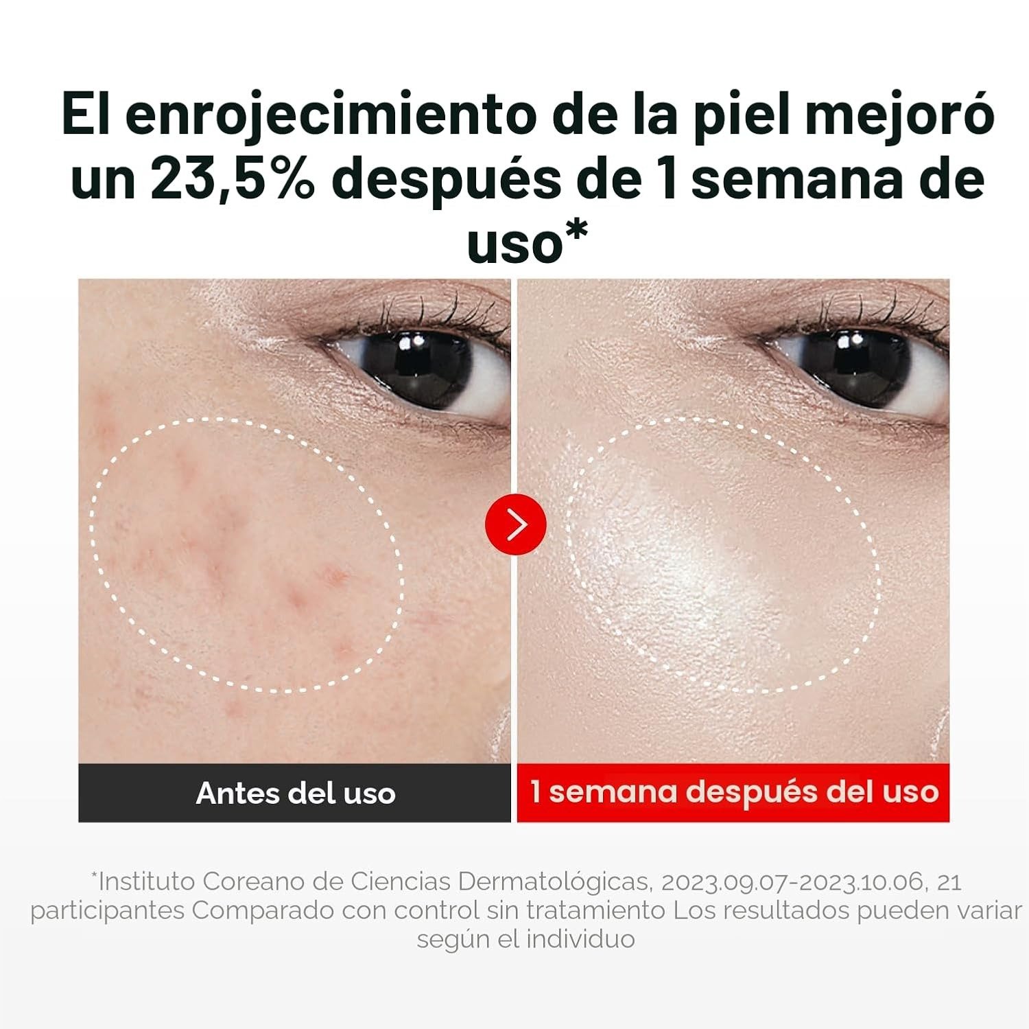 Centellian24 Madeca Cream Time Reverse de Centellian24 — uso | K-Beauty coreano en Narumi Chile